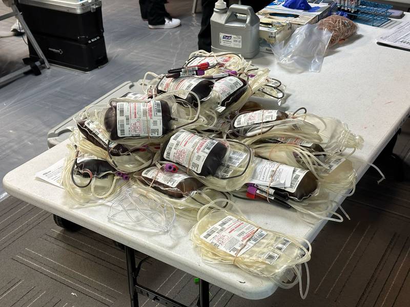 99.5 KISS and 106.7 The Eagle teamed up to bring back the Rock N Roll Up Your Sleeve Blood Drive, to raise critical blood supplies for the South Texas Blood & Tissue Center! Everyone signing up to donate got qualified to win the Ultimate Metallica Collector's Pack!